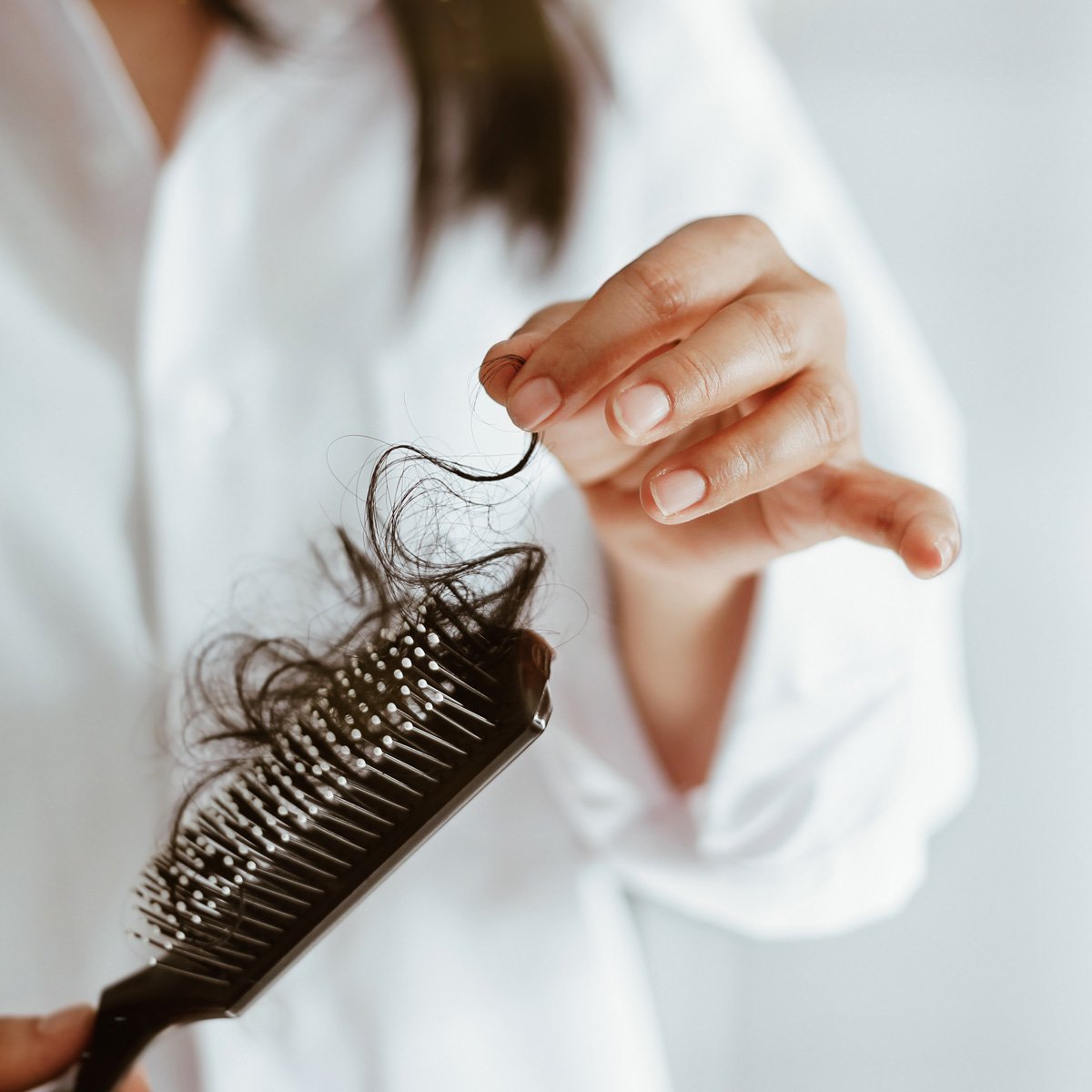 alopecie post partum