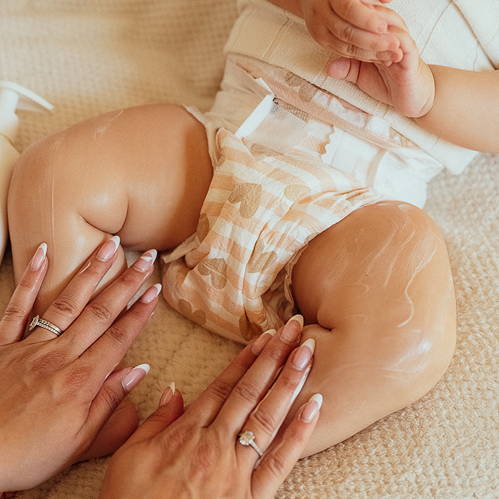 Application d'un soin apaisant sur la peau atopique et l'eczéma d'un nourrisson