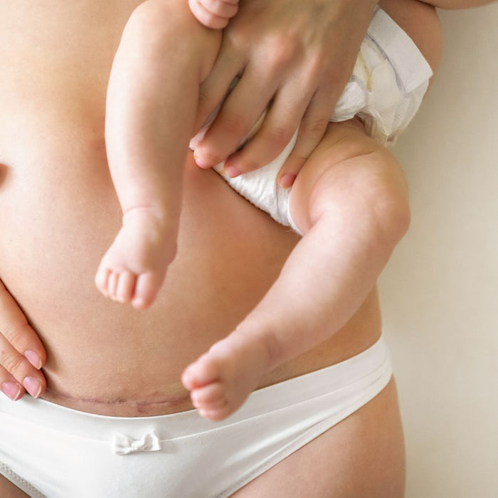 5 conseils pour gérer le traumatisme après un accouchement difficile