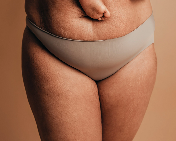 Pourquoi mes parties intimes ne sont plus les mêmes depuis l’accouchement ?