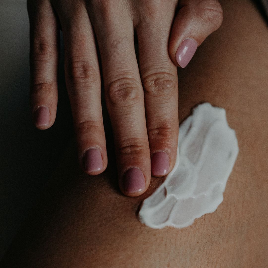 5 mythes et légendes sur les vergetures